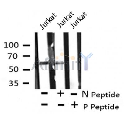 AF8108 staining 293 by IF/ICC. The sample were fixed with PFA and permeabilized in 0.1% Triton X-100,then blocked in 10% serum for 45 minutes at 25¡ãC. The primary antibody was diluted at 1/200 and incubated with the sample for 1 hour at 37¡ãC. An  Alexa Fluor 594 conjugated goat anti-rabbit IgG (H+L) Ab, diluted at 1/600, was used as the secondary antibod