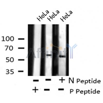 AF8113 staining 293 by IF/ICC. The sample were fixed with PFA and permeabilized in 0.1% Triton X-100,then blocked in 10% serum for 45 minutes at 25¡ãC. The primary antibody was diluted at 1/200 and incubated with the sample for 1 hour at 37¡ãC. An  Alexa Fluor 594 conjugated goat anti-rabbit IgG (H+L) Ab, diluted at 1/600, was used as the secondary antibod