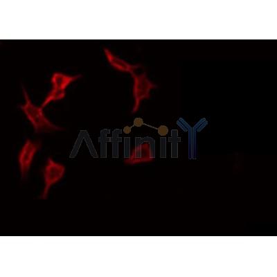 Western blot analysis of extracts from Rat  heart, using ADCK1 Antibody. The lane on the left was treated with blocking peptide.