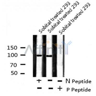 Western blot analysis FKHRL1 (Phospho-Ser644) using Sobital treated 293 whole cell lysates