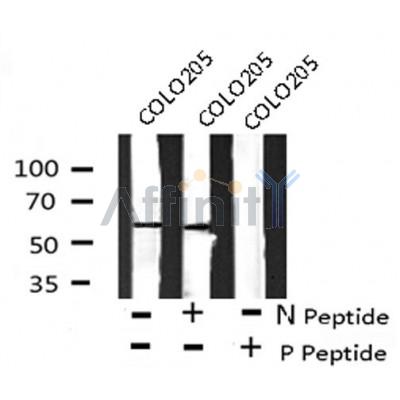 AF8123 at 1/200 staining Rat ganstric tissue sections by IHC-P. The tissue was formaldehyde fixed and a heat mediated antigen retrieval step in citrate buffer was performed. The tissue was then blocked and incubated with the antibody for 1.5 hours at 22¡ãC. An HRP conjugated goat anti-rabbit antibody was used as the secondary