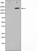 Western blot analysis on A549 cell lysate using MAGI2 Antibody,The lane on the left is treated with the antigen-specific peptide.