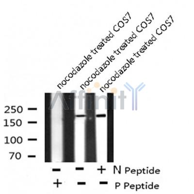 AF8130 staining Hela by IF/ICC. The sample were fixed with PFA and permeabilized in 0.1% Triton X-100,then blocked in 10% serum for 45 minutes at 25¡ãC. The primary antibody was diluted at 1/200 and incubated with the sample for 1 hour at 37¡ãC. An  Alexa Fluor 594 conjugated goat anti-rabbit IgG (H+L) Ab, diluted at 1/600, was used as the secondary antibod
