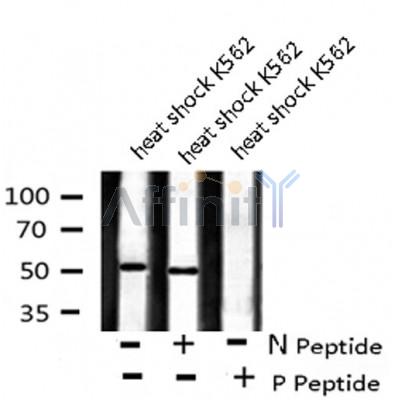 AF8134 staining 293 by IF/ICC. The sample were fixed with PFA and permeabilized in 0.1% Triton X-100,then blocked in 10% serum for 45 minutes at 25¡ãC. The primary antibody was diluted at 1/200 and incubated with the sample for 1 hour at 37¡ãC. An  Alexa Fluor 594 conjugated goat anti-rabbit IgG (H+L) Ab, diluted at 1/600, was used as the secondary antibod