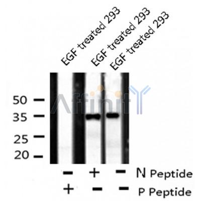 AF8137 staining HepG2 by IF/ICC. The sample were fixed with PFA and permeabilized in 0.1% Triton X-100,then blocked in 10% serum for 45 minutes at 25¡ãC. The primary antibody was diluted at 1/200 and incubated with the sample for 1 hour at 37¡ãC. An  Alexa Fluor 594 conjugated goat anti-rabbit IgG (H+L) Ab, diluted at 1/600, was used as the secondary antibod