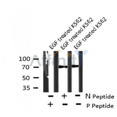 AF8141 at 1/200 staining Rat lung tissue sections by IHC-P. The tissue was formaldehyde fixed and a heat mediated antigen retrieval step in citrate buffer was performed. The tissue was then blocked and incubated with the antibody for 1.5 hours at 22¡ãC. An HRP conjugated goat anti-rabbit antibody was used as the secondary