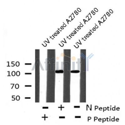 AF8143 at 1/200 staining Rat lung tissue sections by IHC-P. The tissue was formaldehyde fixed and a heat mediated antigen retrieval step in citrate buffer was performed. The tissue was then blocked and incubated with the antibody for 1.5 hours at 22¡ãC. An HRP conjugated goat anti-rabbit antibody was used as the secondary