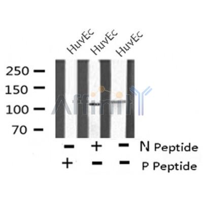 Western blot analysis of ERK5 (Phospho-Thr218+Tyr220) using HuvEc whole cell lysates