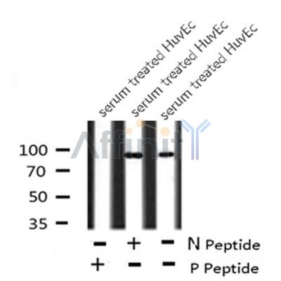 Western blot analysis FGFR3 (Phospho-Tyr760) using serum treated HuvEc whole cell lysates