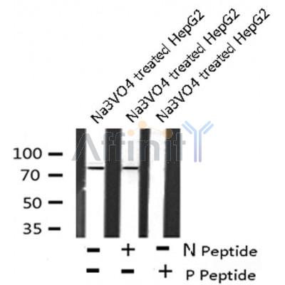 AF8156 at 1/200 staining Rat kidney tissue sections by IHC-P. The tissue was formaldehyde fixed and a heat mediated antigen retrieval step in citrate buffer was performed. The tissue was then blocked and incubated with the antibody for 1.5 hours at 22¡ãC. An HRP conjugated goat anti-rabbit antibody was used as the secondary