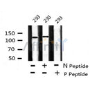 AF8157 staining K562 by IF/ICC. The sample were fixed with PFA and permeabilized in 0.1% Triton X-100,then blocked in 10% serum for 45 minutes at 25¡ãC. The primary antibody was diluted at 1/200 and incubated with the sample for 1 hour at 37¡ãC. An  Alexa Fluor 594 conjugated goat anti-rabbit IgG (H+L) Ab, diluted at 1/600, was used as the secondary antibod