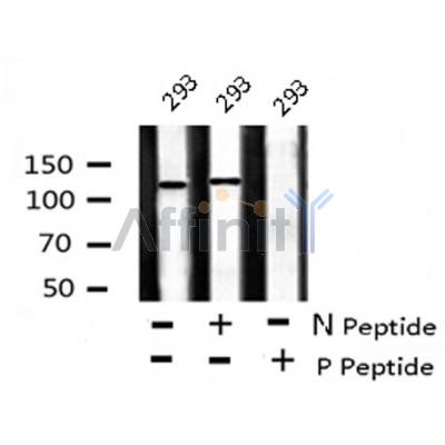 AF8157 staining K562 by IF/ICC. The sample were fixed with PFA and permeabilized in 0.1% Triton X-100,then blocked in 10% serum for 45 minutes at 25¡ãC. The primary antibody was diluted at 1/200 and incubated with the sample for 1 hour at 37¡ãC. An  Alexa Fluor 594 conjugated goat anti-rabbit IgG (H+L) Ab, diluted at 1/600, was used as the secondary antibod