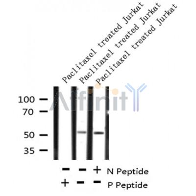 AF8170 at 1/200 staining Rat spleen tissue sections by IHC-P. The tissue was formaldehyde fixed and a heat mediated antigen retrieval step in citrate buffer was performed. The tissue was then blocked and incubated with the antibody for 1.5 hours at 22¡ãC. An HRP conjugated goat anti-rabbit antibody was used as the secondary