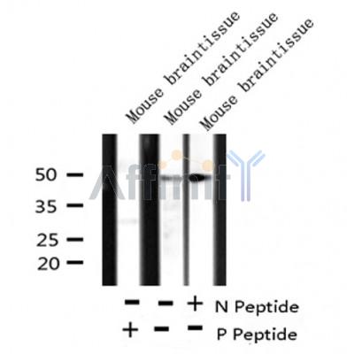 AF8171 at 1/200 staining Rat kidney tissue sections by IHC-P. The tissue was formaldehyde fixed and a heat mediated antigen retrieval step in citrate buffer was performed. The tissue was then blocked and incubated with the antibody for 1.5 hours at 22¡ãC. An HRP conjugated goat anti-rabbit antibody was used as the secondary