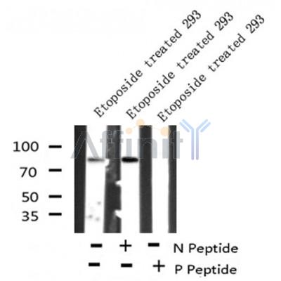AF8172 at 1/200 staining Human pancreas tissue sections by IHC-P. The tissue was formaldehyde fixed and a heat mediated antigen retrieval step in citrate buffer was performed. The tissue was then blocked and incubated with the antibody for 1.5 hours at 22¡ãC. An HRP conjugated goat anti-rabbit antibody was used as the secondary
