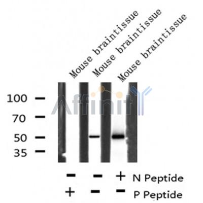 AF8173 at 1/200 staining Rat lung tissue sections by IHC-P. The tissue was formaldehyde fixed and a heat mediated antigen retrieval step in citrate buffer was performed. The tissue was then blocked and incubated with the antibody for 1.5 hours at 22¡ãC. An HRP conjugated goat anti-rabbit antibody was used as the secondary