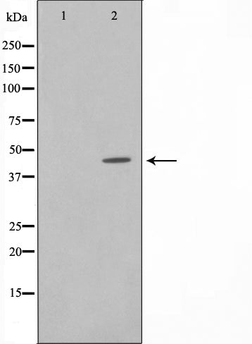Western blot analysis on Jurkat cell lysate using AL2S7 Antibody,The lane on the left is treated with the antigen-specific peptide.