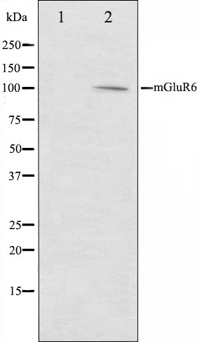 Western blot analysis on mouse brain cell lysate using mGluR6 Antibody,The lane on the left is treated with the antigen-specific peptide.
