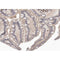 AF0170 at 1/100 staining human colon carcinoma tissue sections by IHC-P. The tissue was formaldehyde fixed and a heat mediated antigen retrieval step in citrate buffer was performed. The tissue was then blocked and incubated with the antibody for 1.5 hours at 22¡ãC. An HRP conjugated goat anti-rabbit antibody was used as the secondary