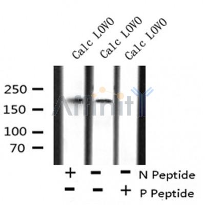AF8180 at 1/200 staining Rat liver tissue sections by IHC-P. The tissue was formaldehyde fixed and a heat mediated antigen retrieval step in citrate buffer was performed. The tissue was then blocked and incubated with the antibody for 1.5 hours at 22¡ãC. An HRP conjugated goat anti-rabbit antibody was used as the secondary