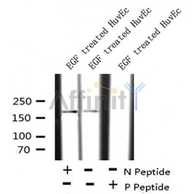 AF8181 at 1/200 staining Rat intestinal tissue sections by IHC-P. The tissue was formaldehyde fixed and a heat mediated antigen retrieval step in citrate buffer was performed. The tissue was then blocked and incubated with the antibody for 1.5 hours at 22¡ãC. An HRP conjugated goat anti-rabbit antibody was used as the secondary