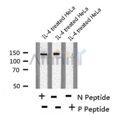 AF8185 at 1/200 staining Rat liver tissue sections by IHC-P. The tissue was formaldehyde fixed and a heat mediated antigen retrieval step in citrate buffer was performed. The tissue was then blocked and incubated with the antibody for 1.5 hours at 22¡ãC. An HRP conjugated goat anti-rabbit antibody was used as the secondary