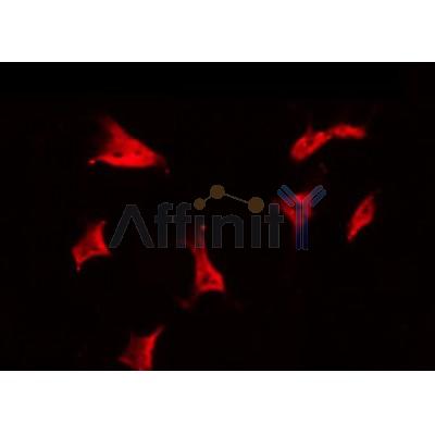 AF0417 staining Hela by IF/ICC. The sample were fixed with PFA and permeabilized in 0.1% Triton X-100,then blocked in 10% serum for 45 minutes at 25¡ãC. The primary antibody was diluted at 1/200 and incubated with the sample for 1 hour at 37¡ãC. An  Alexa Fluor 594 conjugated goat anti-rabbit IgG (H+L) Ab, diluted at 1/600, was used as the secondary antibod