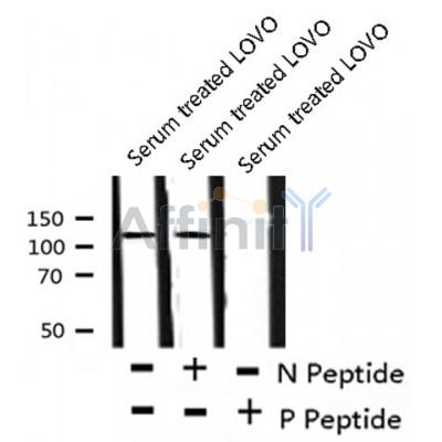 Western blot analysis of TIE1 (Phospho-Tyr1117) using Serum treated LOVO whole cell lysates