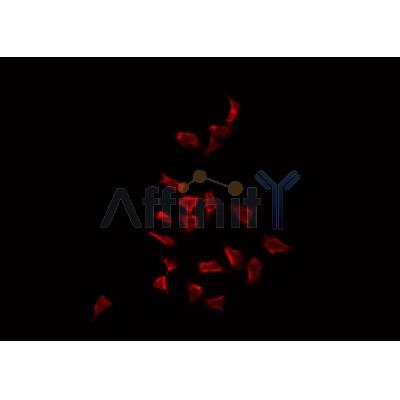 AF0449 staining HepG2 by IF/ICC. The sample were fixed with PFA and permeabilized in 0.1% Triton X-100,then blocked in 10% serum for 45 minutes at 25¡ãC. The primary antibody was diluted at 1/200 and incubated with the sample for 1 hour at 37¡ãC. An  Alexa Fluor 594 conjugated goat anti-rabbit IgG (H+L) Ab, diluted at 1/600, was used as the secondary antibod