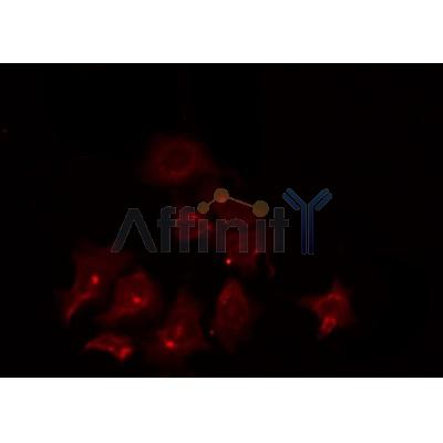 AF0454 staining COLO205 by IF/ICC. The sample were fixed with PFA and permeabilized in 0.1% Triton X-100,then blocked in 10% serum for 45 minutes at 25¡ãC. The primary antibody was diluted at 1/200 and incubated with the sample for 1 hour at 37¡ãC. An  Alexa Fluor 594 conjugated goat anti-rabbit IgG (H+L) Ab, diluted at 1/600, was used as the secondary antibod