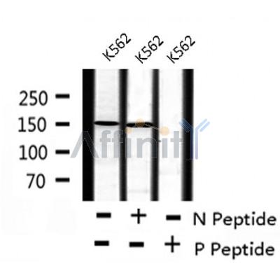 AF8213 staining HeLa by IF/ICC. The sample were fixed with PFA and permeabilized in 0.1% Triton X-100,then blocked in 10% serum for 45 minutes at 25¡ãC. The primary antibody was diluted at 1/200 and incubated with the sample for 1 hour at 37¡ãC. An  Alexa Fluor 594 conjugated goat anti-rabbit IgG (H+L) Ab, diluted at 1/600, was used as the secondary antibod