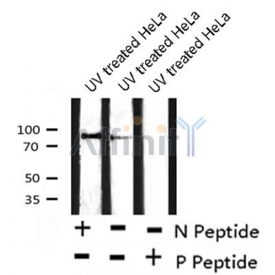 AF8216 at 1/200 staining Rat ganstric tissue sections by IHC-P. The tissue was formaldehyde fixed and a heat mediated antigen retrieval step in citrate buffer was performed. The tissue was then blocked and incubated with the antibody for 1.5 hours at 22¡ãC. An HRP conjugated goat anti-rabbit antibody was used as the secondary