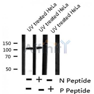 AF8218 at 1/200 staining Rat intestinal tissue sections by IHC-P. The tissue was formaldehyde fixed and a heat mediated antigen retrieval step in citrate buffer was performed. The tissue was then blocked and incubated with the antibody for 1.5 hours at 22¡ãC. An HRP conjugated goat anti-rabbit antibody was used as the secondary
