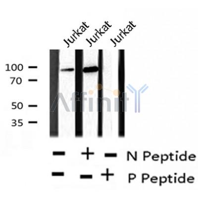 AF8220 staining Hela by IF/ICC. The sample were fixed with PFA and permeabilized in 0.1% Triton X-100,then blocked in 10% serum for 45 minutes at 25¡ãC. The primary antibody was diluted at 1/200 and incubated with the sample for 1 hour at 37¡ãC. An  Alexa Fluor 594 conjugated goat anti-rabbit IgG (H+L) Ab, diluted at 1/600, was used as the secondary antibod