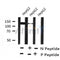 Western blot analysis of PDGFRa (Phospho-Tyr1018) using HepG2 whole cell lysates