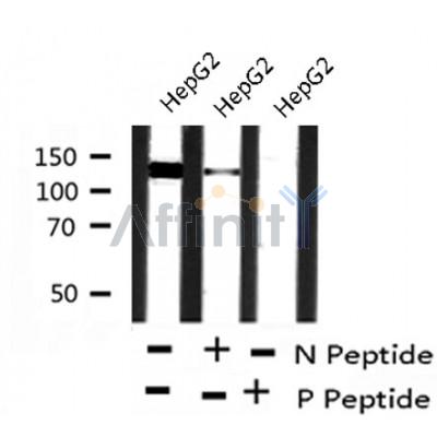 Western blot analysis of PDGFRa (Phospho-Tyr1018) using HepG2 whole cell lysates