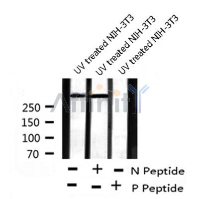Western blot analysis of ATM (Phospho-Ser1981) using UV treated NIH-3T3 whole cell lysates