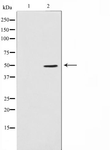 Western blot analysis on Jurkat cell lysate using ADPGK Antibody,The lane on the left is treated with the antigen-specific peptide.