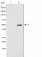 Western blot analysis on Jurkat cell lysate using ADPGK Antibody,The lane on the left is treated with the antigen-specific peptide.