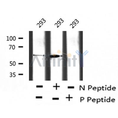 Western blot analysis of extracts from mouse lung, using IFNAR1 (Phospho-Ser535) Antibody.