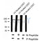 Western blot analysis of Androgen Receptor (Phospho-Tyr534) using UV treated COS7 whole cell lysates
