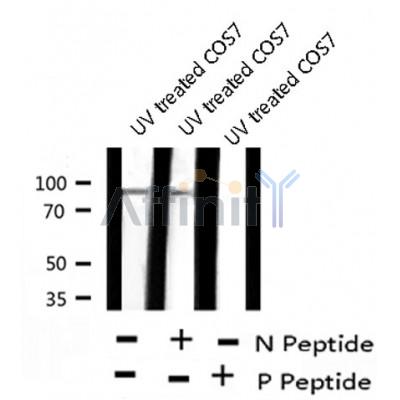Western blot analysis of Androgen Receptor (Phospho-Tyr534) using UV treated COS7 whole cell lysates