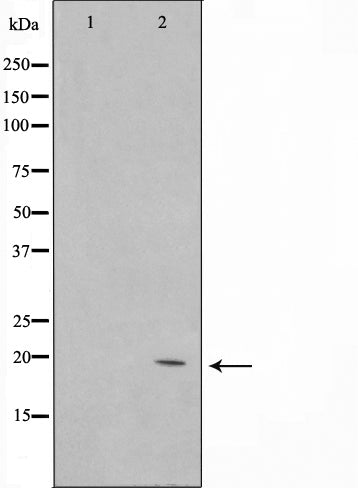 Western blot analysis on Jurkat cell lysate using C1orf57 Antibody