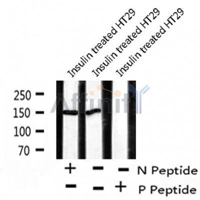 AF8237 at 1/200 staining Rat lung tissue sections by IHC-P. The tissue was formaldehyde fixed and a heat mediated antigen retrieval step in citrate buffer was performed. The tissue was then blocked and incubated with the antibody for 1.5 hours at 22¡ãC. An HRP conjugated goat anti-rabbit antibody was used as the secondary