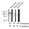 AF8239 at 1/200 staining Human ganstric cancer tissue sections by IHC-P. The tissue was formaldehyde fixed and a heat mediated antigen retrieval step in citrate buffer was performed. The tissue was then blocked and incubated with the antibody for 1.5 hours at 22¡ãC. An HRP conjugated goat anti-rabbit antibody was used as the secondary