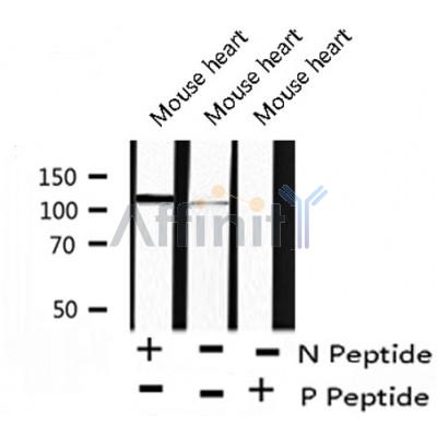AF8239 at 1/200 staining Human ganstric cancer tissue sections by IHC-P. The tissue was formaldehyde fixed and a heat mediated antigen retrieval step in citrate buffer was performed. The tissue was then blocked and incubated with the antibody for 1.5 hours at 22¡ãC. An HRP conjugated goat anti-rabbit antibody was used as the secondary