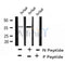 AF8240 at 1/200 staining Rat lung tissue sections by IHC-P. The tissue was formaldehyde fixed and a heat mediated antigen retrieval step in citrate buffer was performed. The tissue was then blocked and incubated with the antibody for 1.5 hours at 22¡ãC. An HRP conjugated goat anti-rabbit antibody was used as the secondary