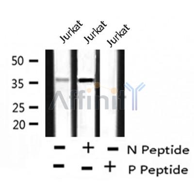 AF8240 at 1/200 staining Rat lung tissue sections by IHC-P. The tissue was formaldehyde fixed and a heat mediated antigen retrieval step in citrate buffer was performed. The tissue was then blocked and incubated with the antibody for 1.5 hours at 22¡ãC. An HRP conjugated goat anti-rabbit antibody was used as the secondary