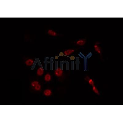 AF0415 staining HuvEc by IF/ICC. The sample were fixed with PFA and permeabilized in 0.1% Triton X-100,then blocked in 10% serum for 45 minutes at 25¡ãC. The primary antibody was diluted at 1/200 and incubated with the sample for 1 hour at 37¡ãC. An  Alexa Fluor 594 conjugated goat anti-rabbit IgG (H+L) Ab, diluted at 1/600, was used as the secondary antibod