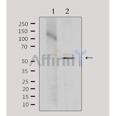 Western blot analysis of extracts from Hela, using TINF2 Antibody. Lane 1 was treated with the antigen-specific peptide.